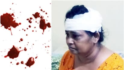 ബാങ്കിലേക്കുള്ള പടികൾ കയറുന്നതിനിടെ വഴുതി വീണ് വീട്ടമ്മയ്ക്ക് ഗുരുതര പരിക്ക്