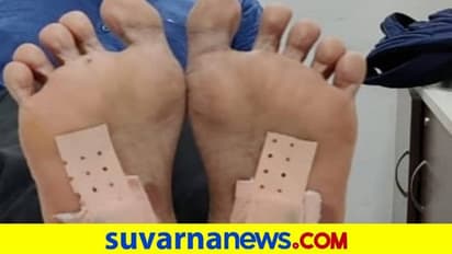 ಅಧಿಕಾರಿಗಳ ಕಣ್ತಪ್ಪಿಸಲು ಪಾದದಲ್ಲಿ ಚಿನ್ನವಿಟ್ಟ ಖದೀಮನ ಬಂಧನ