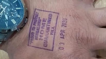 ಇಂದಿನಿಂದ ಕೊರೋನಾ ಸೋಂಕಿತರ ಕೈಗೆ ಸೀಲ್‌..!