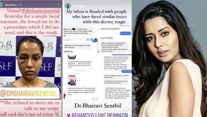 ఫేషియల్ కోసం వెళ్లిన నటిని అందవికారంగా మార్చిన డాక్టర్..గగ్గోలు