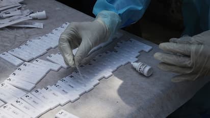 कैसे देखते हैं कोरोना की रिपोर्ट, क्या है RTPCR, एंटीजन और एंटीबॉडी टेस्ट में फर्क?