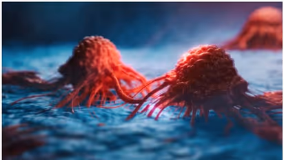 ഈ ഭക്ഷണം കഴിക്കൂ, കാൻസർ സാധ്യത കുറയ്ക്കാം