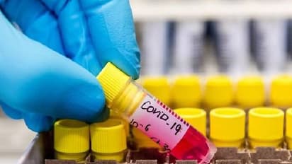 കൊവിഡ് പരിശോധനാ ഫലം ഓൺലൈനായി അറിയാം; ചെയ്യേണ്ടത് ഇങ്ങനെ...