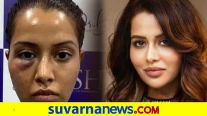 1 ಕೋಟಿ ಕೇಸಿಗೆ 5 ಕೋಟಿ ಮಾನನಷ್ಟ; ಸೇರಿಗೆ ಸವ್ವಾಸೇರು