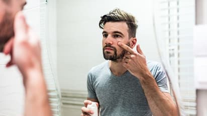 ஆண்களின் முக அழகை கெடுக்கும் பருக்கள்; மறைய இதை செய்ங்க!!