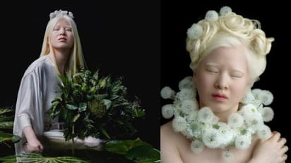 അച്ഛനമ്മമാര്‍ ഗ്രൗണ്ടില്‍ ഉപേക്ഷിച്ച പെണ്‍കുട്ടി ഇന്ന് ഫാഷന്‍ രംഗത്തെ തിളങ്ങുന്ന താരം!