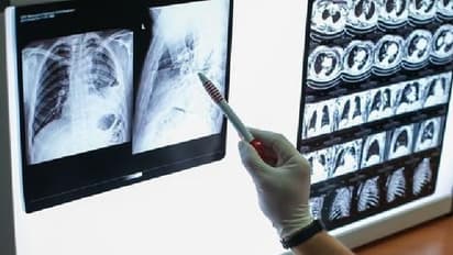 ആര്‍ടിപിസിആര്‍ പരാജയപ്പെടുമ്പോള്‍ കൊവിഡ് നിര്‍ണയത്തിന് സിടി സ്‌കാന്‍?