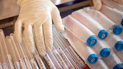 వెయిటింగ్లో 36 లక్షల మంది.. అందుబాటులో 4 లక్షల టీకాలే: తెలంగాణలో సెకండ్ డోస్కు ఇక్కట్లు