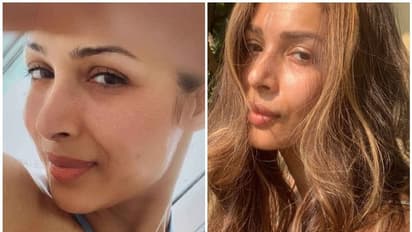 ആരോഗ്യമുള്ള ചര്മ്മത്തിനായി ഈ യോഗാസനങ്ങള് ശീലമാക്കൂ; മലൈക പറയുന്നു