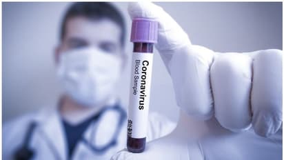 ഈ കൊവിഡ് കാലത്ത് ശ്രദ്ധിക്കേണ്ട മൂന്ന് കാര്യങ്ങളിതാ...