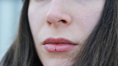 വരണ്ട ചുണ്ടിന് പരിഹാരമുണ്ട്; വീട്ടില് പരീക്ഷിക്കാം ഈ വഴികള്...