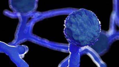 ఏపీలో తొలి బ్లాక్ ఫంగస్ కేసు: నిడదవోలు వ్యక్తిలో లక్షణాలు, స్థానికుల్లో ఆందోళన