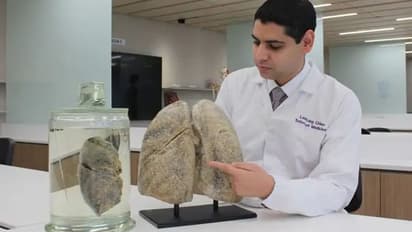 బ్యాక్టీరియా, వైరస్, శిలీంధ్రాల నెట్వర్క్ వల్లే.... ఊపిరితిత్తల ఇన్ఫెక్షన్: సింగపూర్ ఎన్టీయూ అధ్యయనం