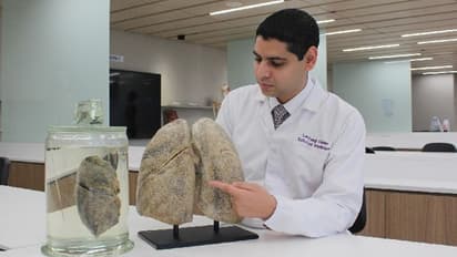 ভাইরাস-ব্যাকটিরিয়া-ফাঙ্গাস, ফুসফুসের সংক্রমণে নেটওয়ার্ক বলল NTU সিঙ্গাপুর