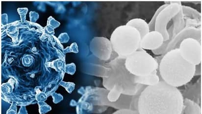 എന്താണ് 'വെെറ്റ് ഫം​ഗസ്'; ആർക്കൊക്കെ പിടിപെടാം?