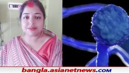 কোভিডেও মিলল না মুক্তি, ব্ল্যাক ফাঙ্গাসে আক্রান্ত হয়ে যুবতীর মৃত্যু কলকাতায়