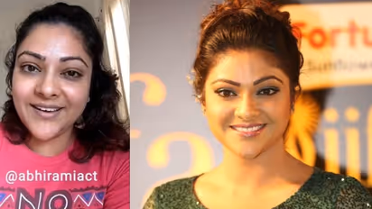 ‘ഒരാളുടെ ലുക്കിനെ അല്ലാതെ, അവരുടെ കഴിവിനെയും നന്മയെയും ഫോക്കസ് ചെയ്യൂ'; അഭിരാമി