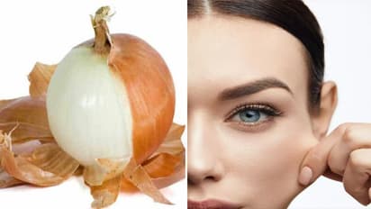 Onion Peel Benefits :  வெங்காயத் தோலில் இத்தனை நன்மைகள் இருக்கா? தெரிஞ்சா இனி குப்பையில் போட மாட்டீங்க..!!
