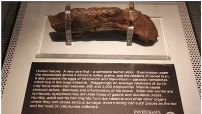 ലോകത്തിലെ ഏറ്റവും വലിയ മനുഷ്യ വിസർജ്ജ്യം യുകെയിലെ മ്യൂസിയത്തിൽ