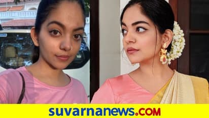 ಚಿಕನ್ ಪಾಕ್ಸ್‌ಗೆ ಗಾಬರಿ ಬೇಡ, ಏನೇ ಮಾರ್ಕ್‌ ಇದ್ದರೂ ಹೋಗುತ್ತದೆ: ನಟಿ ಆಹಾನ ಕೃಷ್ಣ