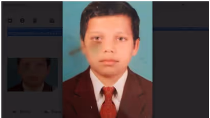 ആക്രമിക്കാനെത്തിയ തെരുവുനായയെ തിരിച്ചാക്രമിച്ച് പത്താംക്ലാസുകാരന്; നായ ചത്തു, കുട്ടിക്ക് കടിയേറ്റു