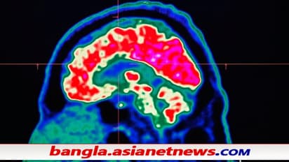 আক্রান্তরা দেখতে পাচ্ছেন মৃতদের, করোনার মধ্যেই রহস্যময় মস্তিষ্কের রোগ - টিকাই কি দায়ী