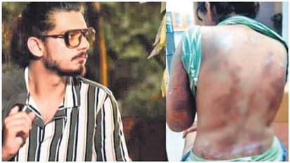 கண்ணில் மிளகாய்ப்பொடி... உடலில் வெந்நீரை ஊற்றி 22 நாட்களாக காதலி பாலியல் பலாத்காரம்... கொடூர சைக்கோ இளைஞன்..!