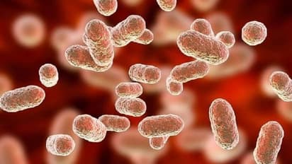 ಕೊರೋನಾ ಹಾವಳಿ ಮಧ್ಯೆ ಕೇರಳದಲ್ಲಿ ಅಂಥ್ರಾಕ್ಸ್‌ ಸ್ಫೋಟ: ತೀವ್ರ ಆತಂಕ