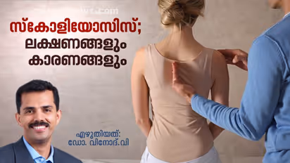 നേരത്തെയറിഞ്ഞാല്‍ സ്‌കോളിയോസിസിനെ ഭയപ്പെടേണ്ട; ഡോക്ടർ എഴുതിയത്