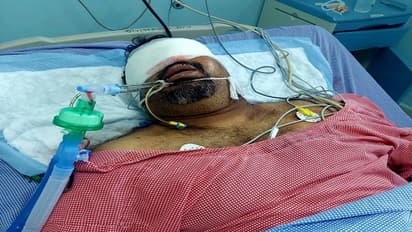 విషమంగా మహేష్ కత్తి ఆరోగ్యం: చెన్నై అపోలోకు తరలింపు