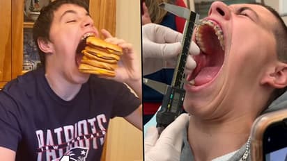 US Teenager sets Guinness World Record For Largest Mouth Gape; Watch Video