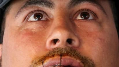 പൌരന്മാരായി അംഗീകരിക്കുക ! ബെല്ജിയത്തില് ചുണ്ടുകള് തുന്നിക്കെട്ടി അഭയാര്ത്ഥികളുടെ നിരാഹാര സമരം