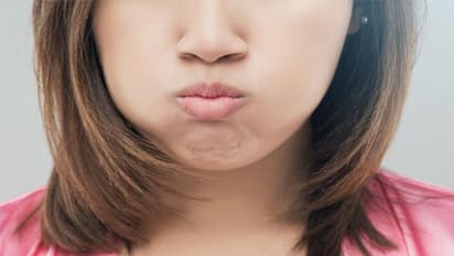 Do you have yellow teeth? Here are some common dental blunders that cause it