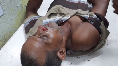 "পরাজিত মুখ্যমন্ত্রীর জঙ্গলরাজে বিধায়কও সুরক্ষিত নন", সোনামুখীর বিজেপি বিধায়ক আক্রান্তের ঘটনায় দাবি শুভেন্দুর