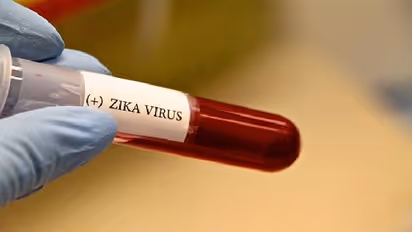 ಚಿಕ್ಕಬಳ್ಳಾಪುರದಲ್ಲಿ ಝೀಕಾ ವೈರಸ್ ಪತ್ತೆ: ಹೈಅಲರ್ಟ್ ಆದ ಆರೋಗ್ಯ ಇಲಾಖೆ