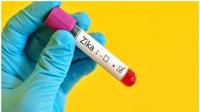 Zika Virus: கர்நாடகாவில் முதல்முறையாக 5 வயது சிறுமிக்கு ஜிகா வைரஸ் தொற்று கண்டுபிடிப்பு: அறிகுறிகள் என்ன?