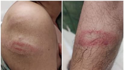 പലചരക്ക് കടയിൽ സാധനങ്ങള് വാങ്ങാനെത്തിയ മാധ്യമ പ്രവര്ത്തകന് പൊലീസ് മര്ദ്ദനം