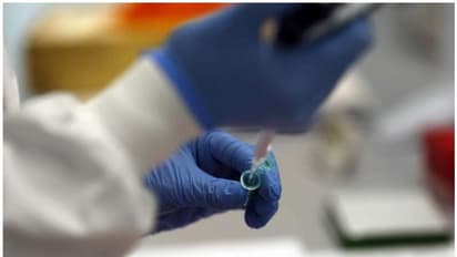 കൊവിഡ് ബാധിച്ച് മരിച്ച 90കാരിയില് ഒരേ സമയം ആൽഫ, ബീറ്റ വകഭേദങ്ങൾ കണ്ടെത്തി; ഇത് അപൂര്വമെന്ന് വിദഗ്ധര്