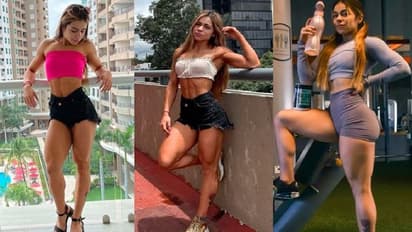 ಬೆವರುವಿಕೆ ಸರಿಪಡಿಸಲು ಸರ್ಜರಿ; 23 ವರ್ಷದ ಇನ್‌ಸ್ಟಾಗ್ರಾಂ ತಾರೆ ಸಾವು!