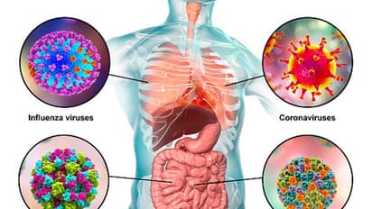 নয়া আতঙ্কের নাম নোরোভাইরাস, করোনা-মাঙ্কি বি-র সঙ্গেই এবার 'ভমিটিং বাগ'এর প্রাদুর্ভাব