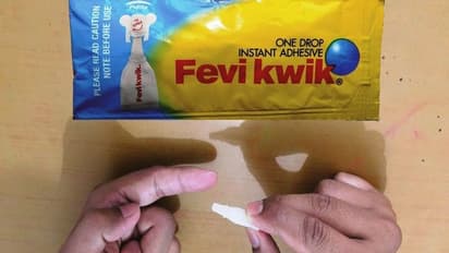 ಯಪ್ಪಾ..ಗಾಯಕ್ಕೆ ಹೊಲಿಗೆ ಹಾಕುವ ಬದಲು ಫೆವಿಕ್ವಿಕ್ ಹಾಕಿದ ಡಾಕ್ಟರ್!