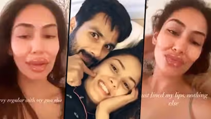 Shocking! What Shahid Kapoor's wife Mira Rajput did to her lip job? Did she undergo a lip job?