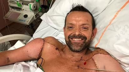 भीषण हादसा कि काटने पड़े थे दोनों हाथ, लेकिन सालों बाद डॉक्टर्स ने कर दिया ऐसा चमत्कार, चौंकाने वाली Photos