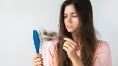 Hair Loss :  മുടി അമിതമായി കൊഴിയുന്നുണ്ടോ? കാരണങ്ങൾ ഇതാകാം