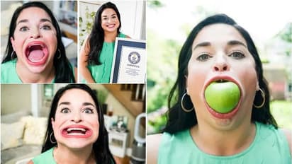 ലോകത്തിലെ ഏറ്റവും വലിപ്പമേറിയ വായ്; ഗിന്നസ് റെക്കോര്ഡ് സ്വന്തമാക്കി യുവതി