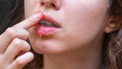 ചുണ്ടുകള്ക്ക് നിറം വയ്ക്കാന് പരീക്ഷിക്കാം ഈ നാടന് വഴികള്...