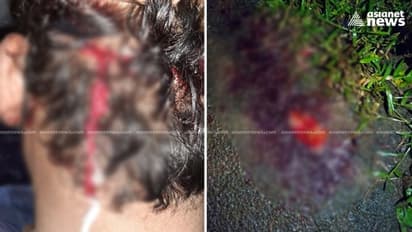 കോഴിക്കോട് സിപിഐ വിട്ട് സിപിഎമ്മിൽ ചേർന്നയാളുടെ തല അടിച്ച് പൊട്ടിച്ചു