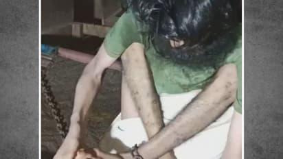 मर गई इंसानियत: परिवार ने 10 साल तक बेटे को जंजीर से बांध जानवरों सा किया सलूक..हालत देख कांपा कलेजा