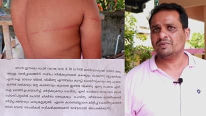 വീടിന് സമീപത്ത് നിന്ന യുവാവിനെ പൊലീസ് അകാരണമായി മർദ്ദിച്ചെന്ന് പരാതി, സംഭവം കഴക്കൂട്ടത്ത്