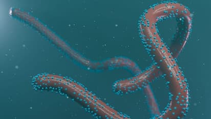 Marburg virus: உலகை பயமுறுத்தும் மார்பர்க் வைரஸ்...கொரோனாவை விட கொடியதாம்..? அறிகுறிகள், பாதிப்புகள் என்னென்ன?